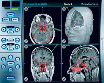 Brain scan Brain scan
