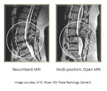 Scan from MRI