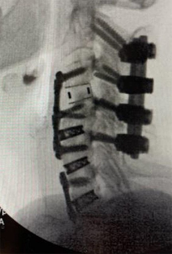 Neck and spine x-ray