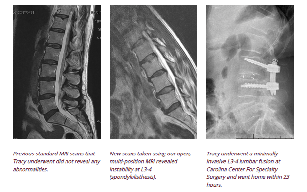 Spine Scans Spine Scans