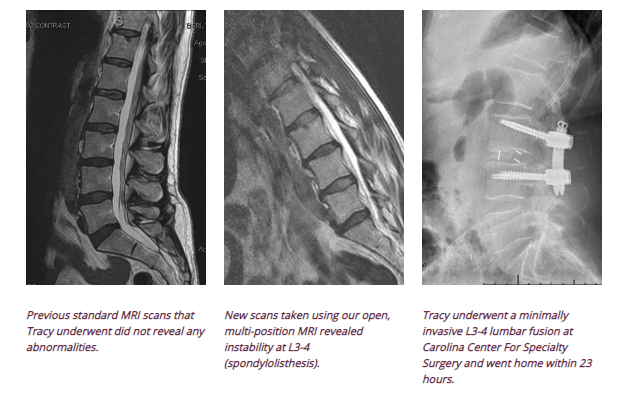 Spine Scans